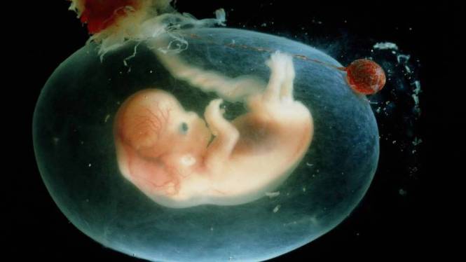 Foto fuente El País